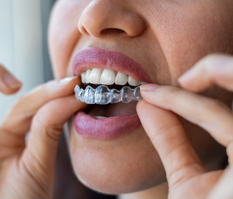 treatment item image