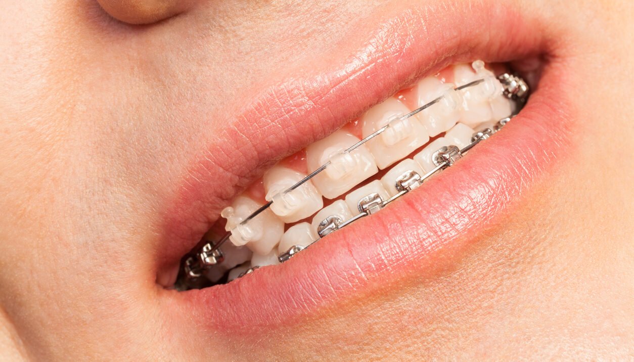 welcome slider image