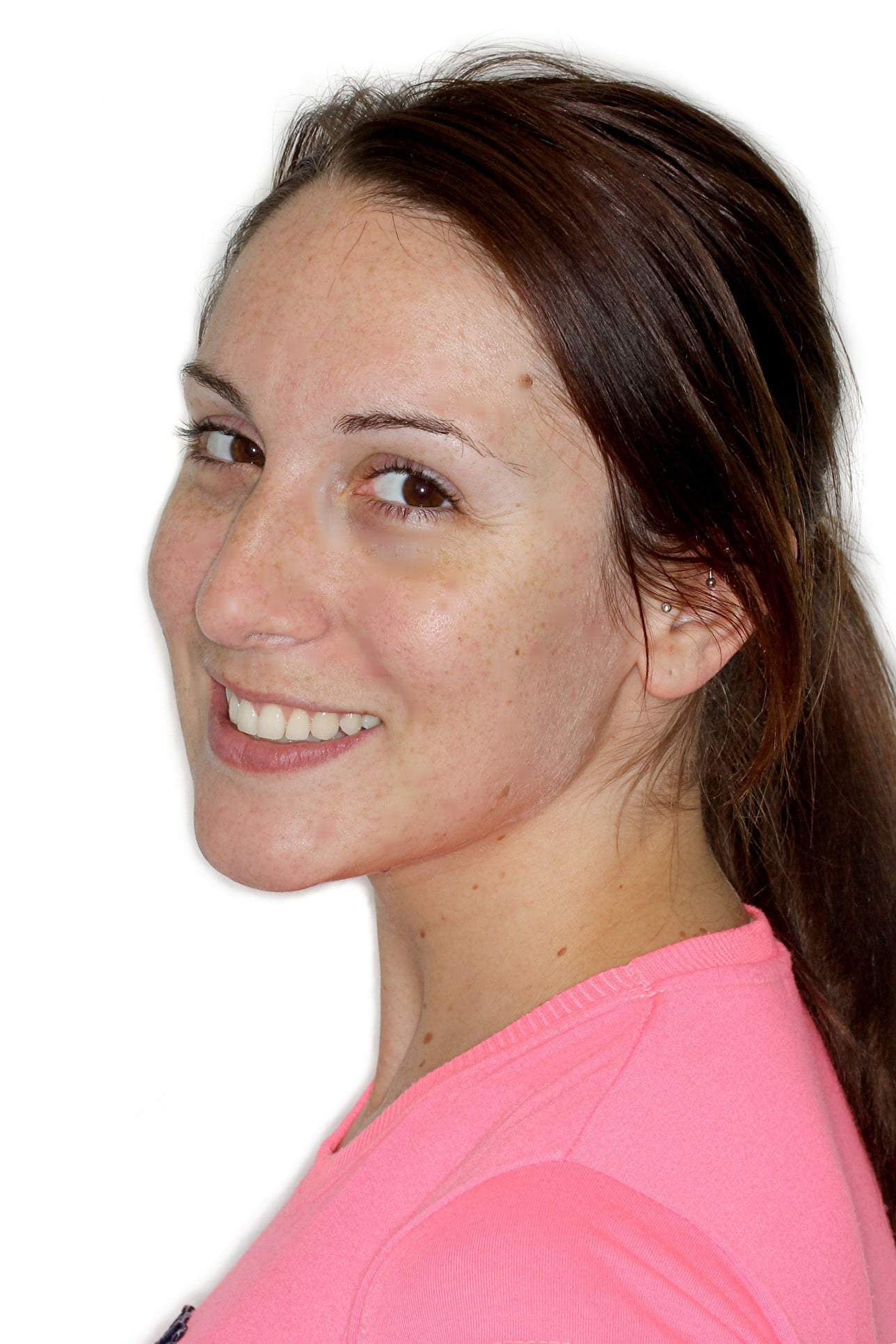 after images gallery