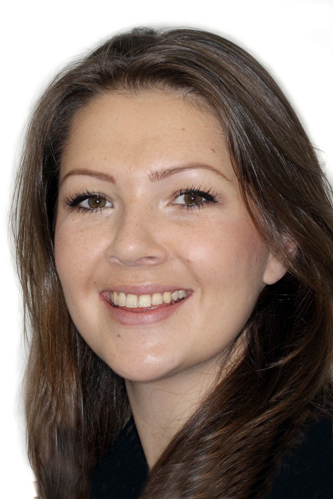 after images gallery