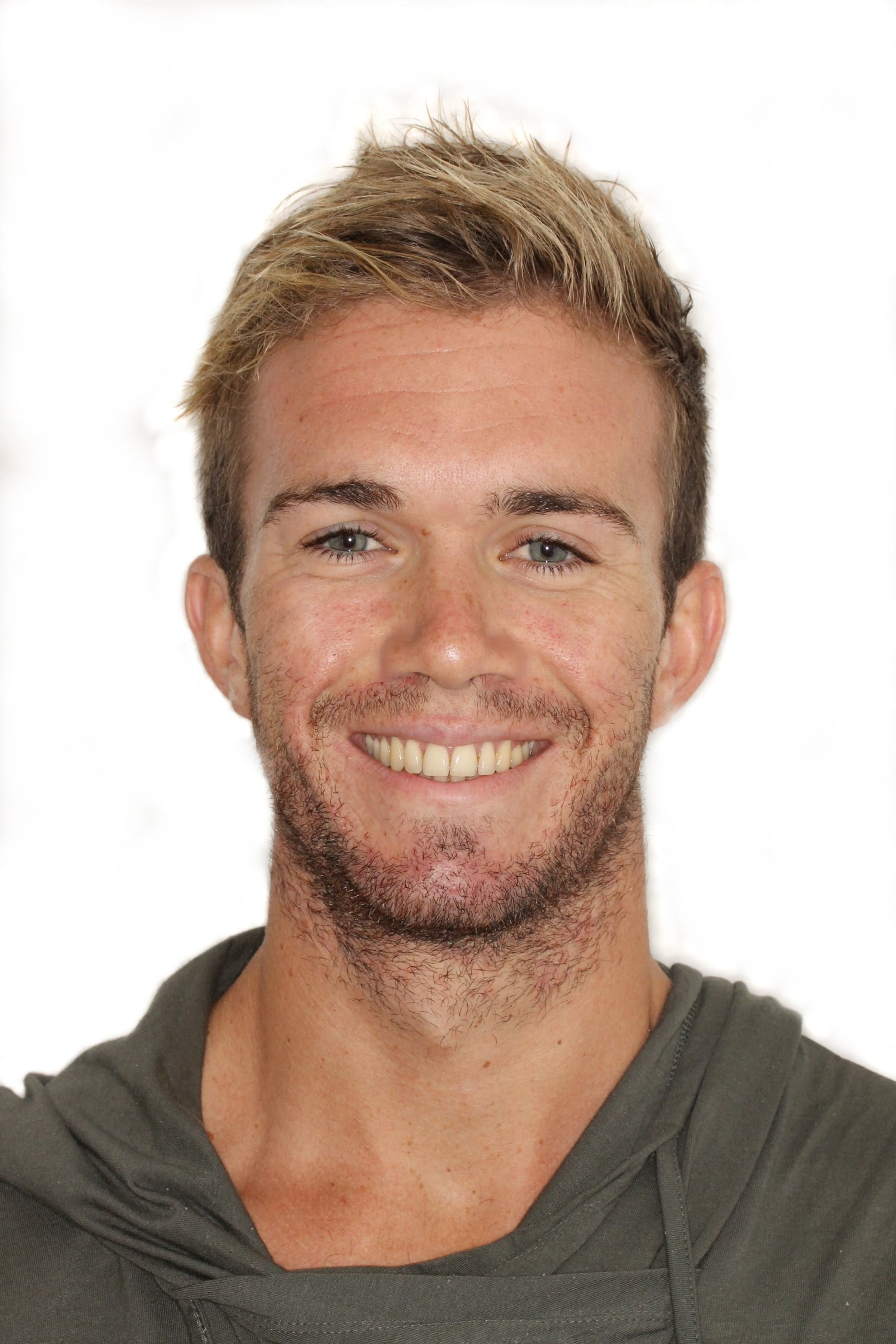 after images gallery