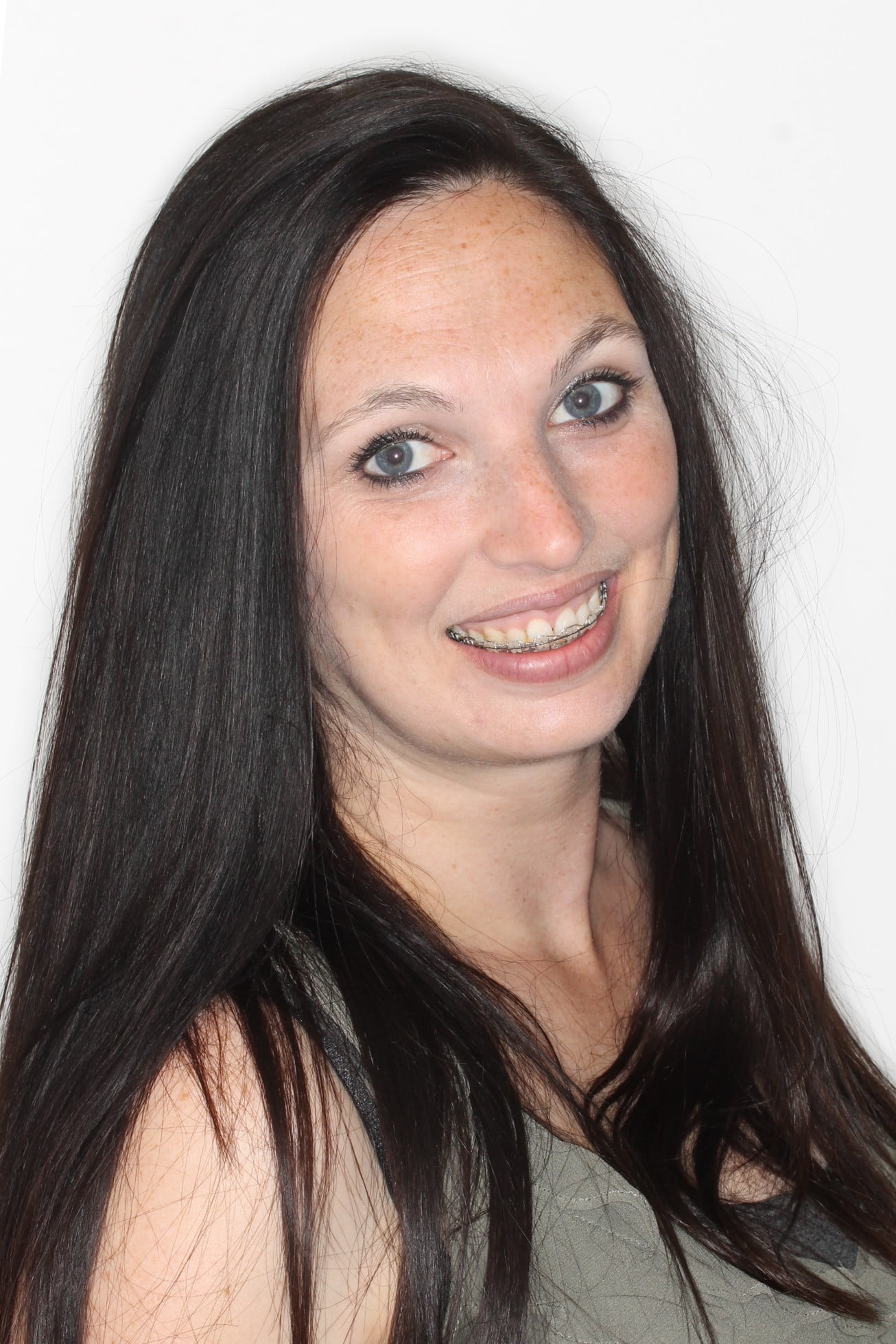 after images gallery