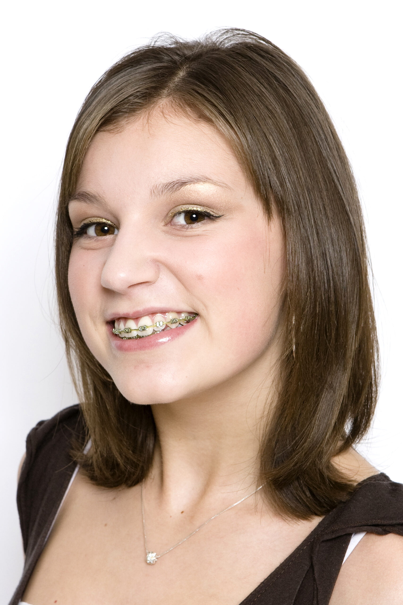 after images gallery