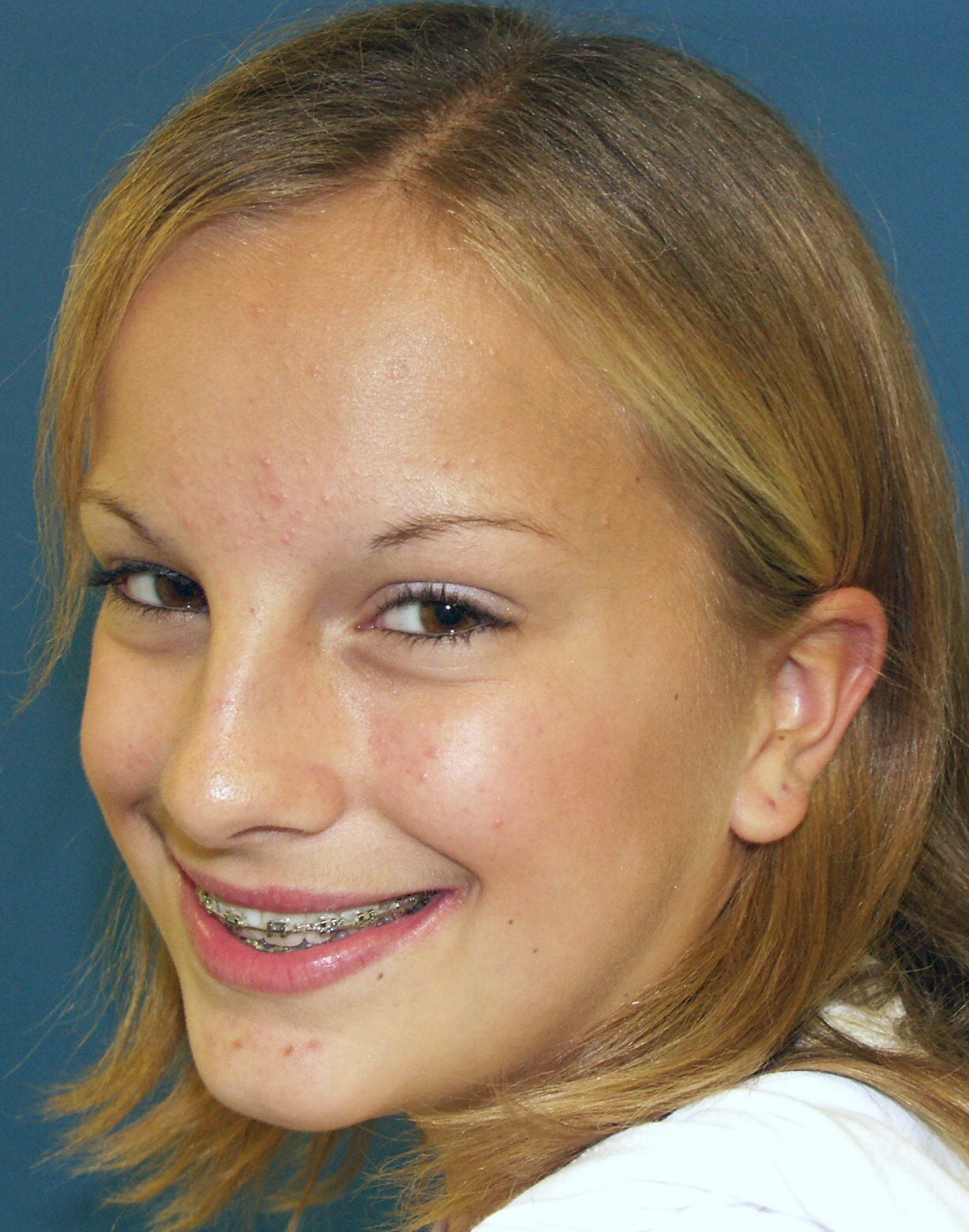 after images gallery