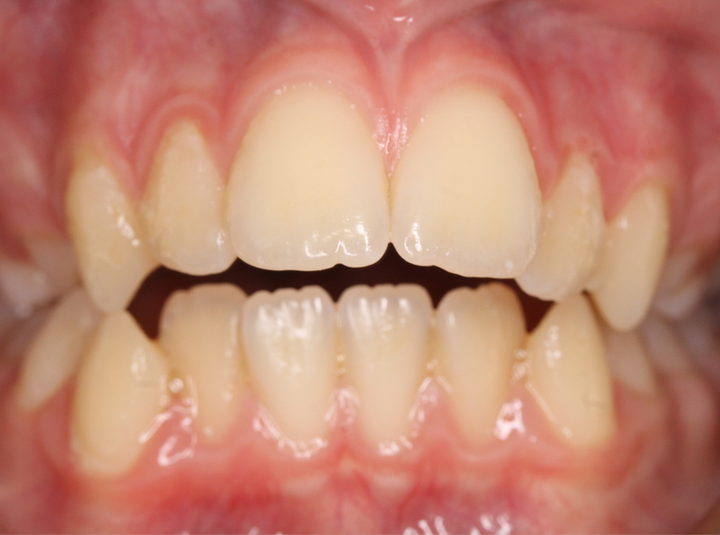 treatment item image