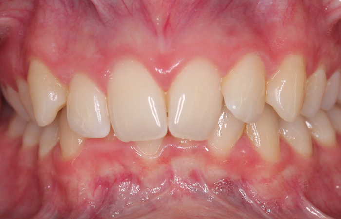 treatment item image