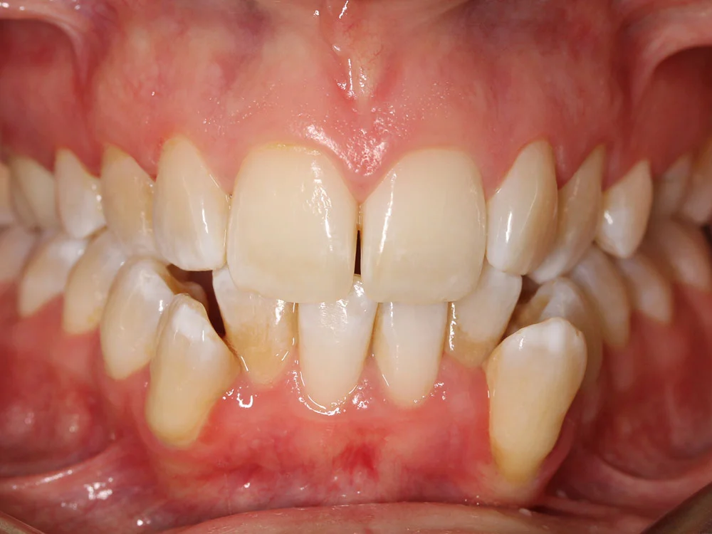 treatment item image